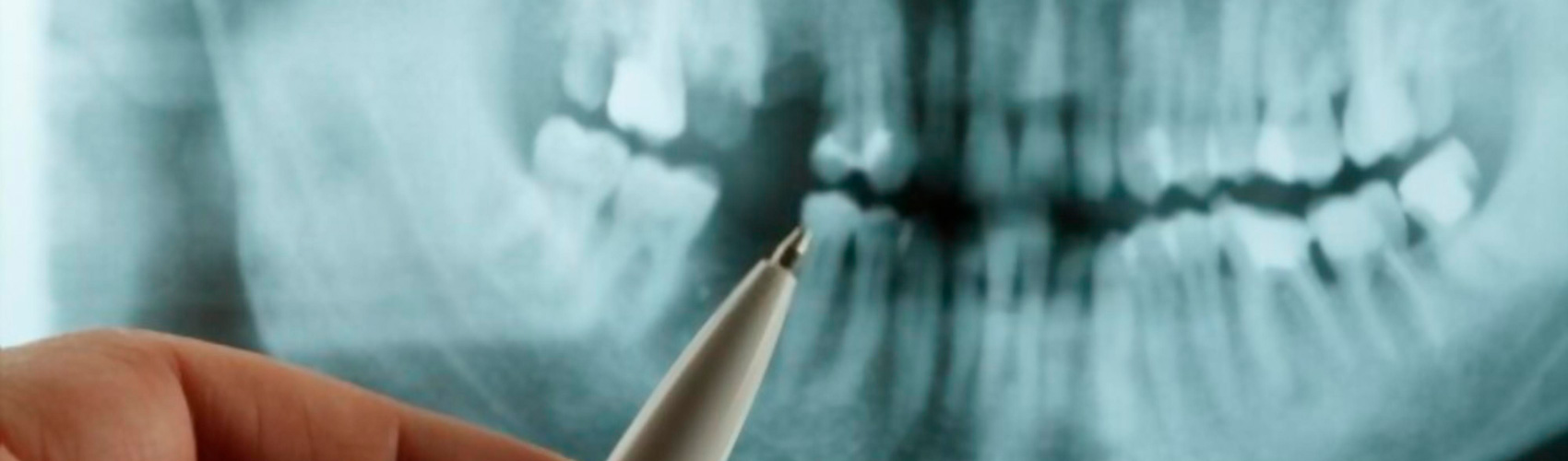 Banner de la Carrera de Odontología